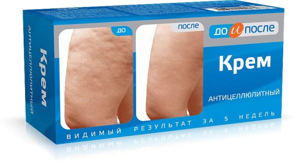 Изображение товара Антицеллюлитный крем «До и после», 100 мл Антицеллюлитный крем «До и после», 100 мл фотография